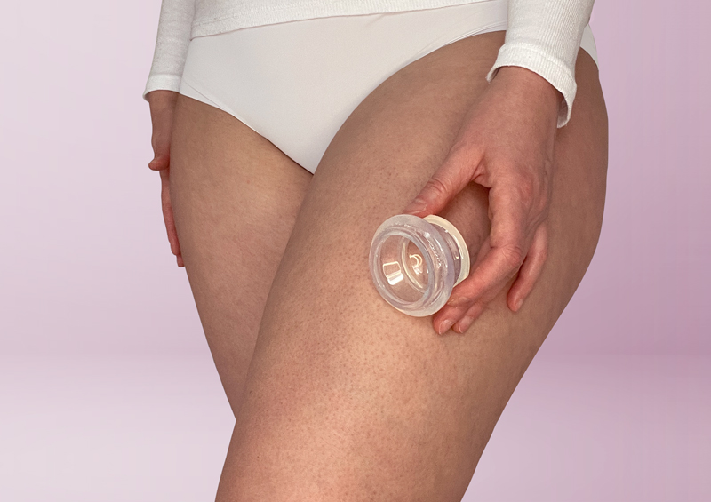 Woche 2 Cellulitefrei medium – Cellulite behandeln mit Schröpfen und Bindegewebe straffen